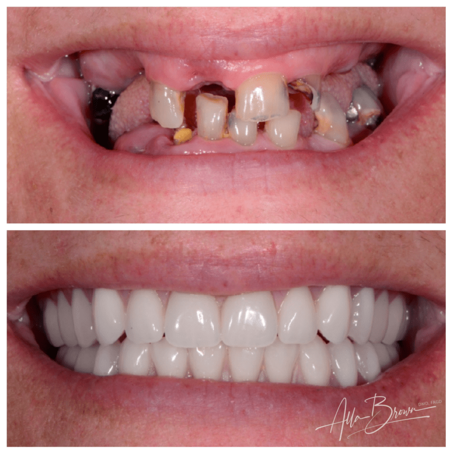 Main Gallery Image 1 | Denture Cases