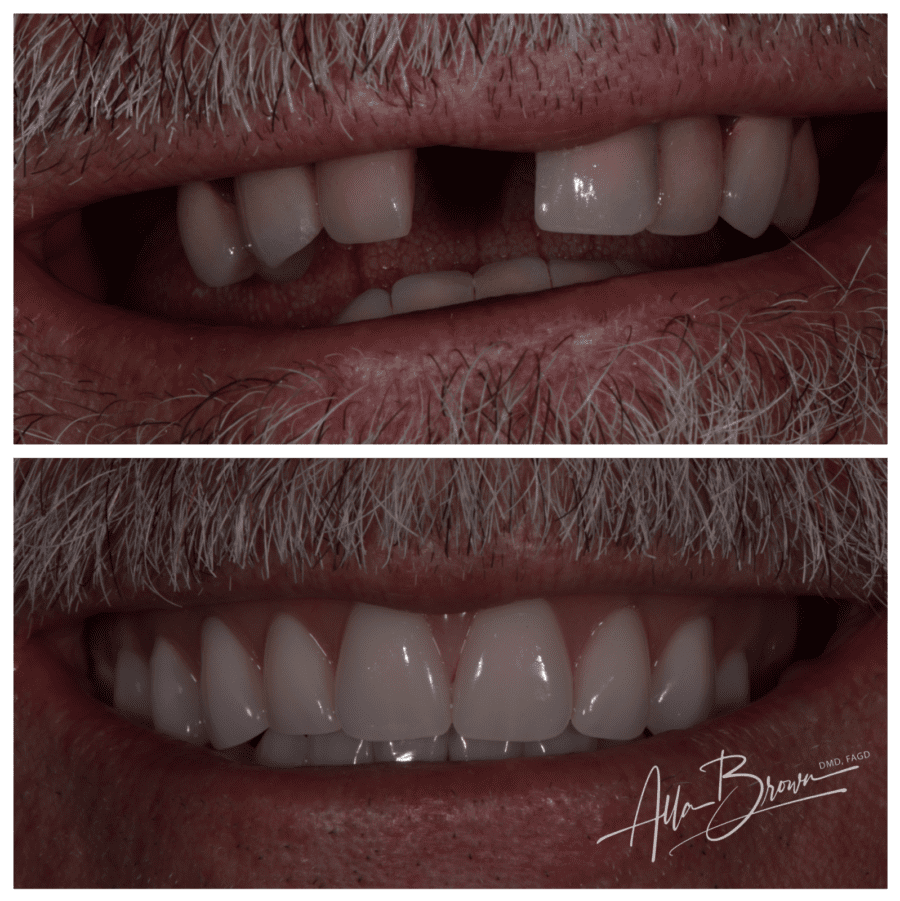 Main Gallery Image 2 | Denture Cases